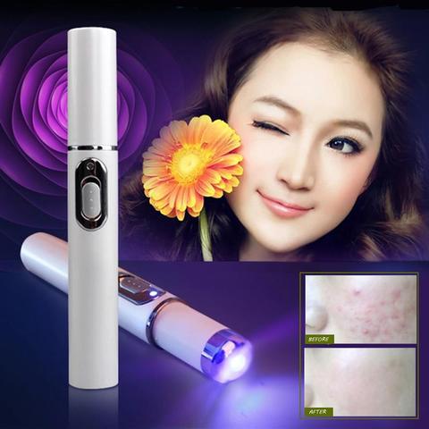 Blue Light Therapy Acne Laser Pen.