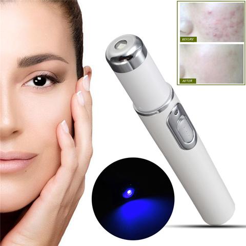 Blue Light Therapy Acne Laser Pen.